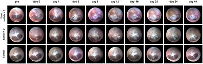 Dual Viscosity Mixture Vehicle for Intratympanic Dexamethasone Delivery Can Block Ototoxic Hearing Loss